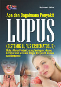 APA DAN BAGAIMANA PENYAKIT LUPUS