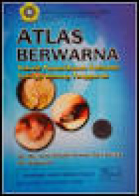 ATLAS BERWARNA Teknik Pemeriksaan Kelainan Telinga hidug tenggorokan