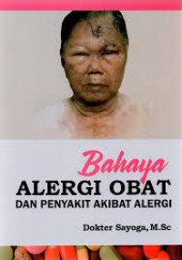 BAHAYA ALERGI OBAT DAN PENYAKIT AKIBAT ALERGI