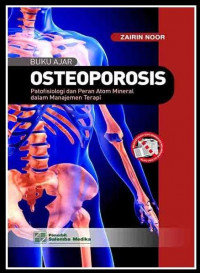 OSTEOPOROSIS