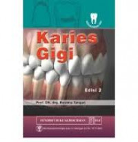 KARIES GIGI