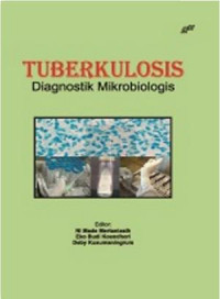 TUBERKULOSIS DIAGNOSTIK MIKROBIOLOGIS